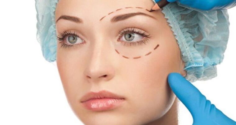 Estiramiento facial quirúrgico